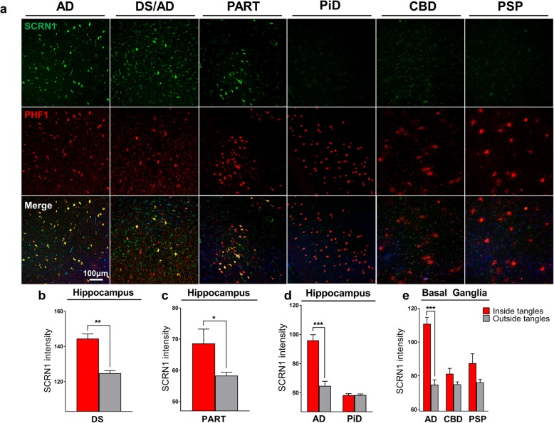 Secernin-1 accumulates in pTau aggregates in AD, DS and PART but not in PiD, CBD and PSP. a SCRN1 colocalization with PHF1 in AD, DS and AD, PART, Pick’s disease, CBD and PSP. Representative images show SCRN1 staining in the hippocampus in AD, DS and AD, PART and Pick’s disease and of SCRN1 staining in the basal ganglia in CBD and PSP. SCRN1 (green) accumulated in neurofibrillary tangles and in dystrophic neurites in AD, Down syndrome and PART but not in PHF1 positive aggregates (red) in PiD, CBD or PSP. b-e SCRN1 levels were significantly higher in PHF1 positive NFTs and dystrophic neurites than in surrounding neurons in both DS (b) and PART (c), similar to AD. There was limited/no co-localization of SCRN1 with pTau positive neuropathological lesions in Pick’s disease (d), Corticobasal Degeneration and Progressive Supranuclear Palsy (e). *** p-value < 0.001, ** p-value < 0.01, * p-value < 0.05; two-tailed paired t-test