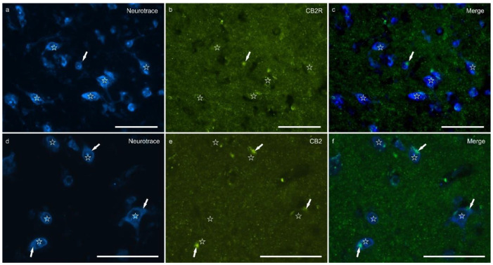 Photomicrographs of the cryosections of the lateral nucleus of the amygdala of a horse showing weak cannabinoid receptor type 2 (CB2R) immunoreactivity in the neuropil varicosities. The stars indicate some neuronal cell bodies labeled with NeuroTrace (a,d) which were CB2R negative (b,e); the white arrows indicate a deposit of autofluorescent pigment within the neuronal cell bodies. Note the diffuse punctate immunoreactivity. (c,f) Merged image. Scale bar = 50 µm.