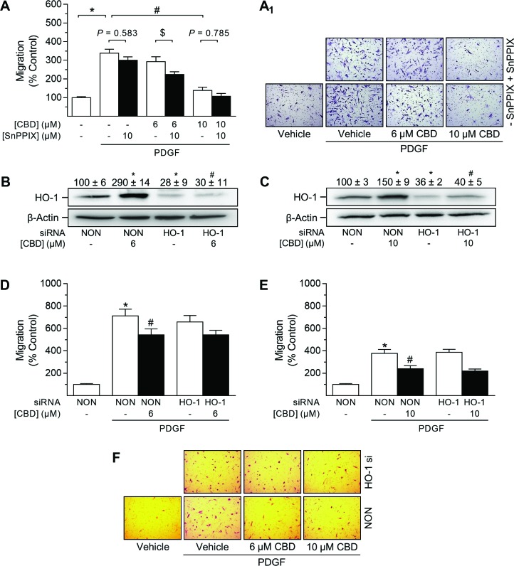 Impact of HO-1 siRNA on CBD-mediated anti-migratory effects in HUASMCCells seeded in rSMCGM (no supplements, 2% FCS) were pre-incubated with 10 µM SnPPIX or vehicle prior to another 24-h co-incubation with vehicle or CBD at the indicated concentrations. Afterwards, viable cells were transferred to Falcon® cell culture inserts. Migration towards PDGF (20 ng/ml) was run for 6 h (A). Cells were transfected with HO-1-specific siRNA or non-targeting siRNA (NON) and incubated in rSMCGM (no supplements, 2% FCS) for 24 h. For Western blot analysis, viable cells were transferred into 6-well plates and incubated with CBD or vehicle for 6 h prior to sample preparation (B, C). For migration, viable cells were transferred into Falcon® cell culture inserts and incubated with CBD or vehicle for 1 h prior to the initiation of a 6-h migration period toward PDGF (20 ng/ml) or appropriate vehicle in the lower plate. Thereafter, inserts were prepared and migrated cells were counted in five randomly selected fields per insert (A, D, E). Representative images of migration analyses are shown in (A1, F). Protein expression values were normalized to β-actin. Percentage of control represents comparison with the respective vehicle-treated time-matched group (set as 100%). Western blot images are representative of each experiment. Values are means ± SEM of n = 15 (A), n = 3 (B, C), n = 28–36 (D) or n = 25 (E) experiments. *P < 0.05 vs. PDGF-free vehicle control (A, D, E) or NON-transfected control cells (B, C); #P < 0.05 vs. PDGF-treated vehicle control (A, D, E) or NON-transfected CBD-treated cells (B, C); $P < 0.05 as indicated; one-way ANOVA plus Šidák post hoc test.