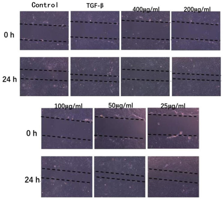 Images of healing condition of HDF scratches after 24 h.