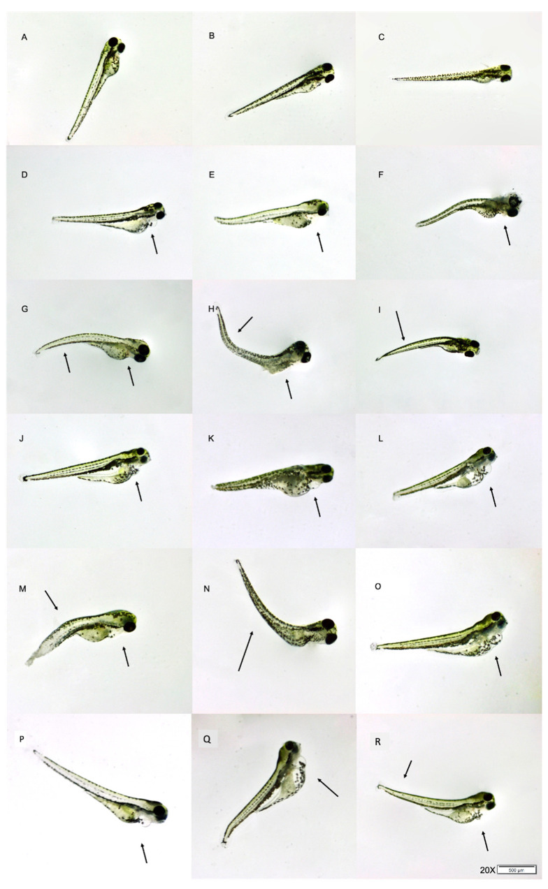 Morphological malformations of 5 dpf zebrafish exposed to THC. (A–C) Vehicle control larvae, (D–F) exposed to 1.00 mg/L, (G–I) larvae exposed 1.25 mg/L, (J–L) larvae exposed to 1.50 mg/L, (M–O) larvae exposed to 2.00 mg/L and (P–R) larvae exposed to 2.25 mg/L. Representative malformations are indicated by arrows.