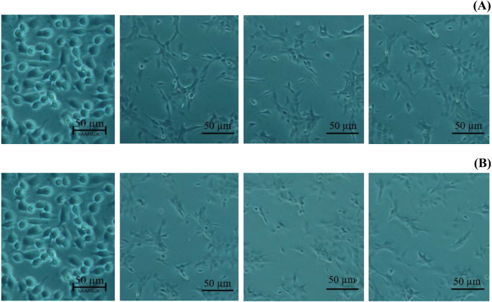 Morphological changes of BF-2 cell lines in the highest concentration of leaves lipophilic extract (A) and β-sitosterol (B) (% cell viability < 100%).