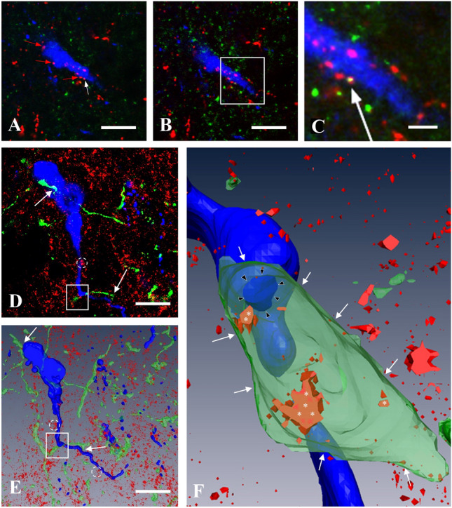 CB1-immunoreactivity in KP afferents of GnRH neurons in the medial preoptic area of OVX-EB mice. Demonstration of appearance of CB1-immunoreactivity in one of the KP-IR afferent fiber (white arrow) in confocal microscopic Z-stack series. A A single optical slice shows multiple KP-immunoreactive (IR) varicosities (red and white arrows) in apposition to a GnRH-IR neuron (blue). B is an adjacent optical slice. The boxed area in this image is magnified in C to demonstrate the yellow-colored double-labeled KP-IR varicosity (white arrow). D Yellow fluorescent protein (YFP)-positive, green-colored axon varicosities (KP fibers after viral and immunohistochemical detection) in apposition to two adjacent gonadotropin-releasing hormone (GnRH)-IR cells (blue) shown in merged three optical slices. E The 3D rendered view of all optical slices of the same structures. The GnRH neurons are embedded in a tissue showing punctate CB1-IR sites (red), where CB1-IR clusters (dotted circles) and KP-IR fibers (white arrows) are in association with GnRH-IR cell bodies or processes. F The projection image of the 3D reconstructed area of E (white rectangle) is shown at higher power. Some of the CB1-IR sites (white asterisks) are visible only, if the KP-IR fiber is made semi-transparent. The CB1-IR sites in the membrane of the KP-IR fiber (white arrows) turn up in orange-red color marking co-localization. The contact site between the KP fiber and the GnRH dendron is marked by black arrowheads. Scale bar 10 µm (on A, B, D, E) and 5 µm (on C)