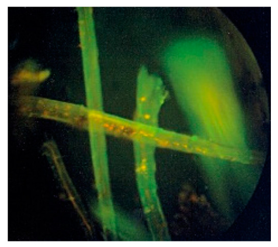 Dew retted hemp fibers activity towards Staphylococcus aureus bacteria, the killed bacterias take the form of orange particles. The strains of the clinical Staphylococcus aureus bacteria were isolated from ill people after 90 min of incubation.
