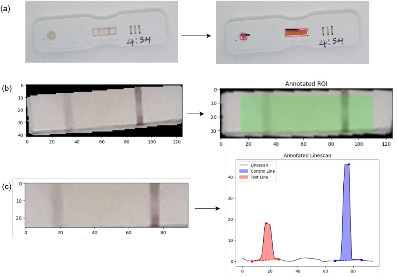 Image analysis pipeline for automated signal processing of lateral flow assays