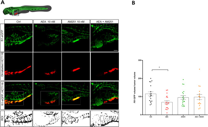 AEA reduces vascularization in fli1-GFP positive xenografts.A Representative confocal z-stack images of 5 dpf (3 dpi) larvae with the tumor highlighted by the red fluorescence (Dil Vibrant red staining) and blood vessels marked by the green fluorescence (Tg(fli1:EGFP)y1 line). Scale bar 100 µm. The white box indicates the region of interest (ROI) selected to quantify the vascularization. B Quantification of total green fluorescence of the ROI analyzed with Fiji. The mean value in the Ctrl was settled as 100%. The error bar indicates SEM. Statistical analysis was performed using one-way ANOVA. *p < 0.05; (Ctrl n = 18; AEA n = 18; AM251 n = 19; AEA + AM251 n = 16 from three independent experiments). Image created with Biorender.com.