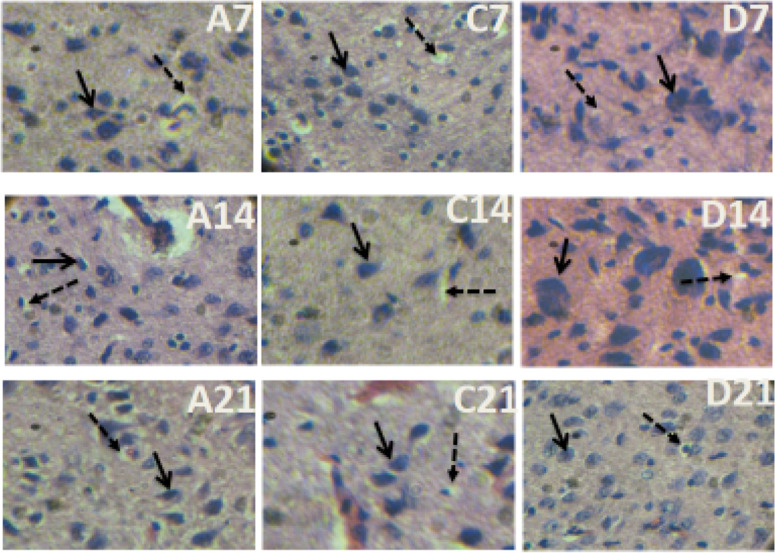 A photomicrograph of a section of the SC of Groups A, C, and D on Days 7, 14, and 21. H&E x400Observe that neurons in the treatment groups C and D have a large, rounded nucleus (arrows) compared with group A (control) Moreover, observe large vacuolations (dashed arrows) within the cytoplasm in the treatment groups compared with the control group.
