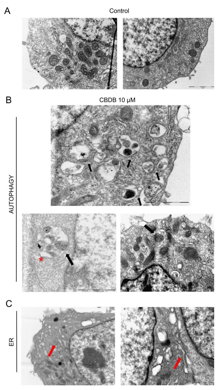 Representative TEM images of cell morphology. (A) MCF-7 control cells (treated with DMSO, as vehicle). Scale bar 2 μm. (B,C) MCF-7 cells fixed exposed to CBDB or CBDP (10 µM) for 24 h; (B) double-membrane autophagic vacuoles red asterisk, autophagosomes red arrows, (C) outstretched ER black arrows.