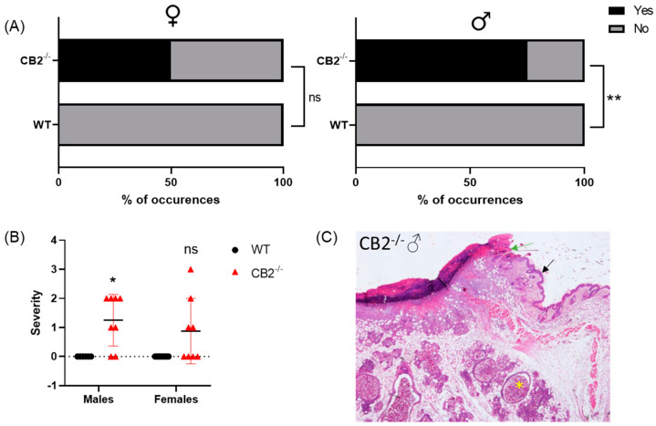 CB2-/- is associated with increased risk of skin cancer in aged male mice. (A) Odd’s ratio in CB2-/- mice to develop cancerous and pre-cancerous lesions (“yes” occurrences) in the skin as assessed histopathologically in females (left) and males (right); ** p < 0.01, ns: not significant versus WT mice for females, Fisher’s exact test. (B) Severity of dysplasia according to the scale: 0–normal tissue; 1–chronic inflammation, ulceration, atrophy, or hyperplasia; 2–cellular atypia, metaplasia, or mitotic figures; 3–dysplasia; 4–positive carcinoma. (C) Histological section of left flank of CB2-/- male stained with hematoxylin and eosin; epidermis (black arrow), ulceration of the skin (green arrow), and dermal cystic structures (yellow star). Original magnification ×40. Mann–Whitney U test, * p < 0.05.
