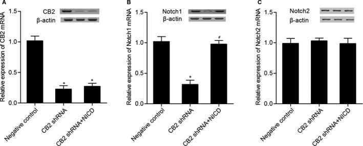 (A) CB2 levels in CB2 shRNA and CB2 shRNA + NICD groups were much lower than that in the NC group (*P value <.05 vs negative control group). (B) Notch I level in CB2 shRNA + NICD and NC groups was much higher than that in the CB2 shRNA group (*P value <.05 vs negative control group; #P value <.05 vs CB2 shRNA group). (C) CB2 shRNA and CB2 shRNA + NICD had no effect on Notch 2 expression