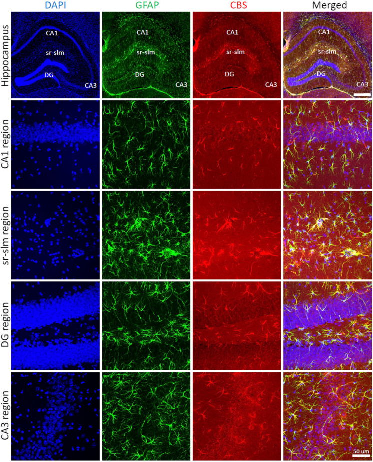 CBS expression is primarily localized in astrocytes in the mouse hippocampus. Immunohistochemical staining of wild-type mouse brain sections was analyzed in 4 different regions of the hippocampus (CA1, sr-slm, DG, CA3). Images in the top row were acquired using NanoZoomer fully automated slide scanner in 2D at × 5 magnification. Images in the other rows were acquired using confocal microscopy in 3D at × 40 magnifications and are shown as maximum intensity projections of the whole z-stack of 30 μm. Immunofluorescence labeling for marker of astrocytes GFAP (green), CBS (red), and counterstaining with DAPI (blue) is shown. Note the colocalization of CBS with GFAP in all regions of the hippocampus