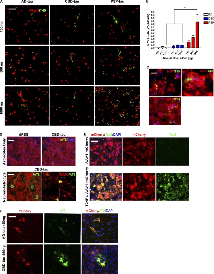 Seeding of cultured oligodendrocytes and astrocytes with tau strains. (A) ICC for Olig-2 (red) and T49 (green) after seeding of oligodendrocyte cultures with AD-tau (n = 3 cases), CBD-tau (n = 3 cases), and PSP-tau (n = 1 case). Four independent experiments. Scale bar, 50 µm. (B) Quantification of T49+ cells from A. Mean ± SEM plotted. Two-way ANOVA with Bonferroni post hoc test. P = 0.0246 (**, P < 0.01). (C) ICC for MBP (red), CNP (red), GFAP (red), and T49 (green) after seeding with PSP-tau (500 ng/coverslip). Two independent experiments. Scale bar, 50 µm. (D) Top: ICC for GFAP (red) and AT8 (green) of astrocyte cultures seeded with CBD-tau (450 ng/coverslip). Bottom: ICC for GFAP (red, astrocyte) and AT8 (green; left) and MAP2 (red, neuron) and AT8 (green; right) of neuron–astrocyte co-cultures seeded with CBD-tau (450 ng/coverslip). Dulbecco's PBS (dPBS) used as control. Two independent experiments. Scale bars, 50 µm. (E) ICC for Tau5 (green) and mCherry (red) post-viral transfection of T34PL-AAV1-mCherry or AAV1-mCherry in astrocyte cultures. Two independent experiments. Scale bar, 50 µm. (F) ICC for AT8 (green) and mCherry (red) in virally transfected astrocytes seeded with AD-tau (n = 3 cases) or CBD-tau (n = 3 cases) at 450 ng/coverslip. Two independent experiments. Scale bar, 50 µm.