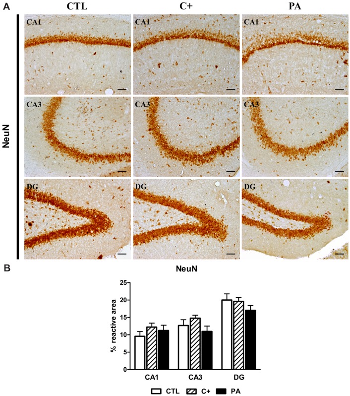 NeuN immunostaining in dorsal hippocampus. (A) Photomicrographs of NeuN-positive cells in CA1, CA3, and DG regions of the dorsal hippocampus in CTL, C+ and PA groups. Scale bars = 15 μm. (B) Percentage of NeuN immunopositive area in CA1, CA3, and DG regions of the dorsal hippocampus in all the experimental groups. Bars and error bars show the mean + SEM of 5–7 observations per animal of a total of six rats per group. CTL, control group; C+, cesarean section group; PA, perinatal asphyxia group; CA1, cornu ammonis 1; CA3, cornu ammonis 3; DG, dentate gyrus.