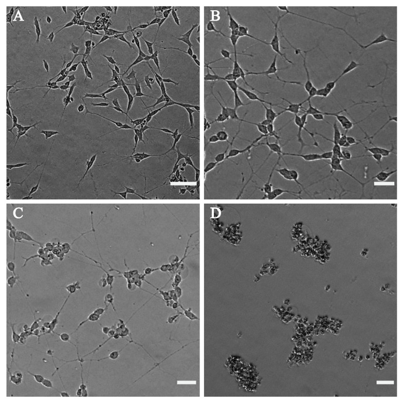 Phase-contrast microscope images of differentiated SH-SY5Y after treatment with (A) DMSO as the control, (B) 0.1 µg mL−1 CBD, (C) 2 µg mL−1 CBD and (D) 10 µg mL−1 CBD. CBD at a concentration of 10 µg mL−1 (D) and above shows dead cells, at 2 µg mL−1 (C) causes cell body rounding and less affected neurites, whereas at 0.1 µg mL−1 (B), the phenotype is almost similar to the DMSO ((A), vehicle only control) phenotype. Images were taken using the EVOS M5000 Imaging System at 10× magnification. The scalebar indicates 50 µm.