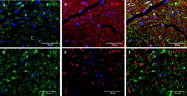 Double immunofluorescence staining of the sciatic nerve of a six-month-old dog.P0, a marker for myelinating Schwann cells (red, B) and CB1 (green, A) co-localize in about 100% of Schwann cells (C). p75NTR (red, E) and CB1 (green, D) do not co-localize (F), suggesting the absence of CB1 receptors in non-myelinating Schwann cells. Nuclear staining (blue) with bisbenzimid.