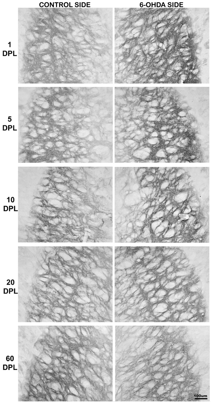 Temporal changes of CB1 expression in the EGP of PD-induced rats.CB1 expression in external globus pallidus (EGP) of rats submitted to unilateral intrastriatal injections of 6-OHDA after 1, 5, 10, 20, and 60 days post-lesion (DPL). Digital images of coronal sections of the EGP show an increase of CB1 expression in the experimental side at earlier time points.