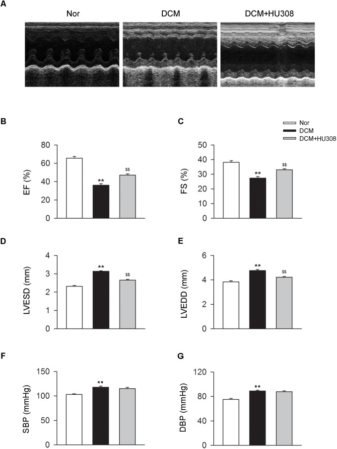 Administration of HU308 improves cardiac function in DCM mice. DCM mice model was created by intraperitoneal injection of streptozotocin (STZ) at the dose of 50 mg/kg body weight per day for five consecutive days. HU308 (3 mg/kg body weight) was administrated every day from 12 to 14 weeks after the final injection of STZ. Normal saline was used as vehicle. (A) Representative M-mode echocardiographic images on mice at 14 weeks after the final injection of STZ. (B–E) Quantitative analysis of cardiac function measurements including EF (%), FS (%), LVESD and LVEDD (n = 7). ∗∗P < 0.01 vs. Nor group; $$P < 0.01 vs. DCM group. (F,G) Quantitative analysis of SBP and DBP (n = 7). ∗∗P < 0.01 vs. Nor group. Nor, normal; DCM, diabetic cardiomyopathy.