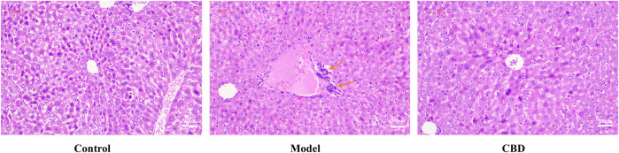 HE staining of mice liver tissue (100X, orange arrows: inflammatory cell infiltration).