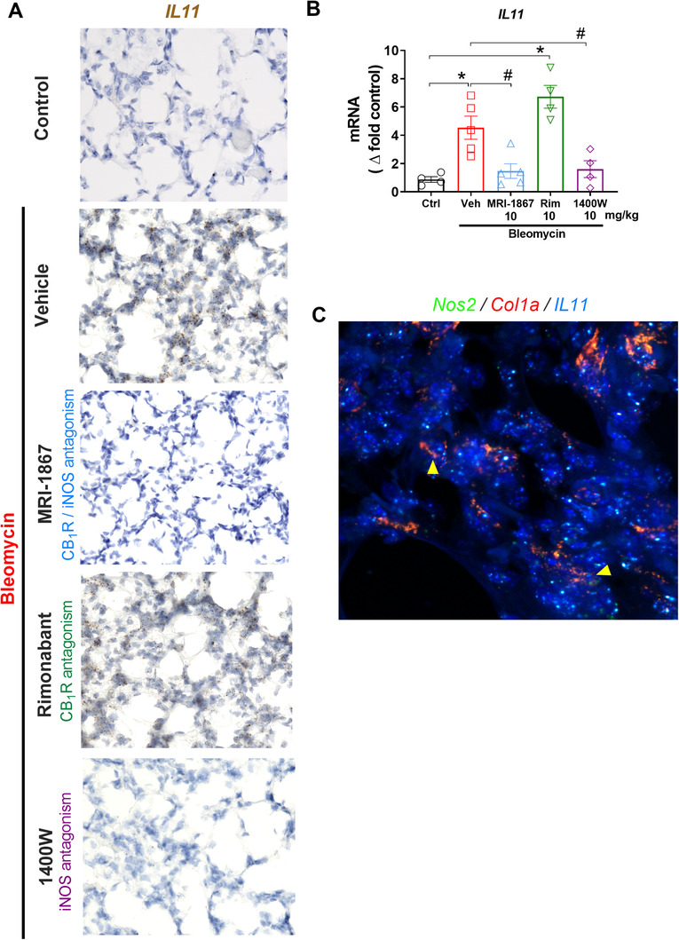 iNOS activation regulates interleukin‐11 (IL‐11) expression in lungs during bleomycin‐induced HPSPF in pale ear mice. Gene expression of IL‐11 in lung tissue sections by RNAscope in situ hybridization (ISH) was performed on fixed lung tissue sections (A) and by real‐time PCR in lung homogenate (B) in pale ear mice. Colocalization of Nos2 and IL11 in Col1a expressing cells by RNAscope in situ hybridization (ISH) (C). Data represent mean ± SEM. n = 4 mice for control (Ctrl, pale ear mice infused with saline instead of bleomycin), n = 5 HpsPF mice for vehicle (Veh), n = 5 HpsPF mice for MRI‐1867 (Hybrid CB1R/iNOS inhibitor)‐treated group, n = 4 HpsPF mice for rimonabant (Rim, CB1R antagonist), and n = 4 mice for 1400W (iNOS inhibitor)‐treated group. Data were analyzed by one‐way ANOVA followed by Dunnett's multiple comparisons test. * (p < 0.05) indicates significant difference from the control group. # (p < 0.05) indicates significant difference from the HpsPF mice treated with vehicle (Veh) at 42 day