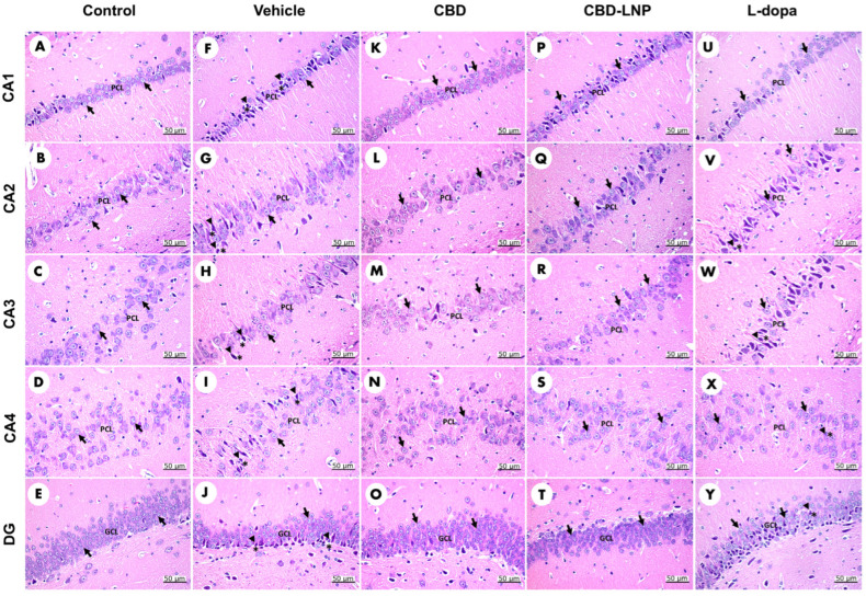 Morphological evaluation of H&E-stained sections in the CA1, CA2, CA3, CA4, and dentate gyrus regions of the hippocampus in diabetic Parkinson’s disease (DP) rats. Control rats (A–E) display normal neuron cells (arrow). Vehicle-treated DP rats (F–J) exhibit neuron cells (arrow) alongside highly condensed pyknotic nuclei (head arrow) and pericellular haloes (asterisk). CBD-treated DP rats (K–O) also show normal neuron cells (arrow). CBD-LNP-treated DP rats (P–T) reveal numerous normal neuron cells (arrow) with reduced pyknotic nuclei (head arrow) and pericellular haloes (asterisk). Levodopa-treated DP rats (U–Y) display normal neuron cells (arrow) along with pyknotic nuclei (head arrow) and pericellular haloes (asterisk). Scale bars represent 50 µm (magnification, 40×). PCL, pyramidal cell layer; GCL, granule cell layer.