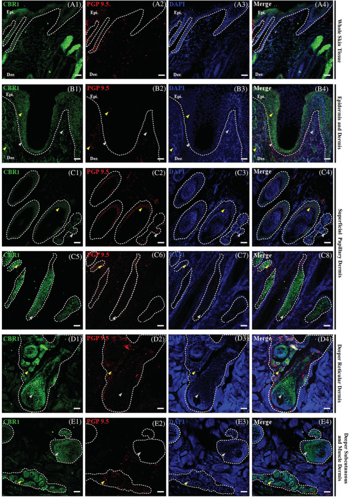 Triple confocal microscopic in‐situ expression of CBR1 (green), PGP 9.5 (red) and DAPI (blue) in the whole skin tissue under 20x magnification; scale bars = 50 μm (A1‐A4). Below, a set of images presenting the layers of the equine skin, with emphasis on their respective epidermal and dermal compartments. Epidermis (Epi.: stratum basale, granulosum, spinosum and corneum; B1‐B2) and dermis (B1‐B2) and dermis (Der.: upper and lower superficial papillary dermis—C1‐C8, deeper reticular dermis—D1‐D4, and deep subcutaneous and muscle dermis—E1‐E4) with their respective compartments. The specific region of interest (white dotted lines) and randomly selected example regions with single CBR1 (gray arrows) and double positive in co‐localization with PGP 9.5 (yellow arrows) specific immunoreactivity are indicated. Images were taken at 40x magnification; scale bars = 20 μm