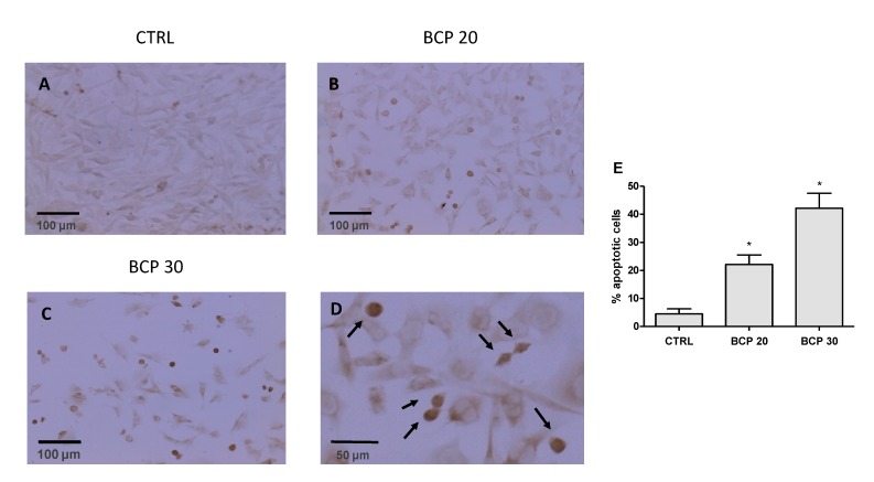 Effect of BCP on apoptosis induction in U373 cells. The detection of apoptosis was assessed by TUNEL (Terminal deoxynucleotidyl transferase dUTP nick end labeling) assay. In the images (panels A–C; scale bar = 100 μm), brown color reaction indicates cells that underwent apoptosis. Panel D shows cells at higher magnification (scale bar = 50 μm) and TUNEL—positive cells are indicated by arrows. Quantitative results are presented as a percentage of TUNEL-positive (panel E). The data are expressed as the mean ± SD; * p < 0.001 vs. the control.