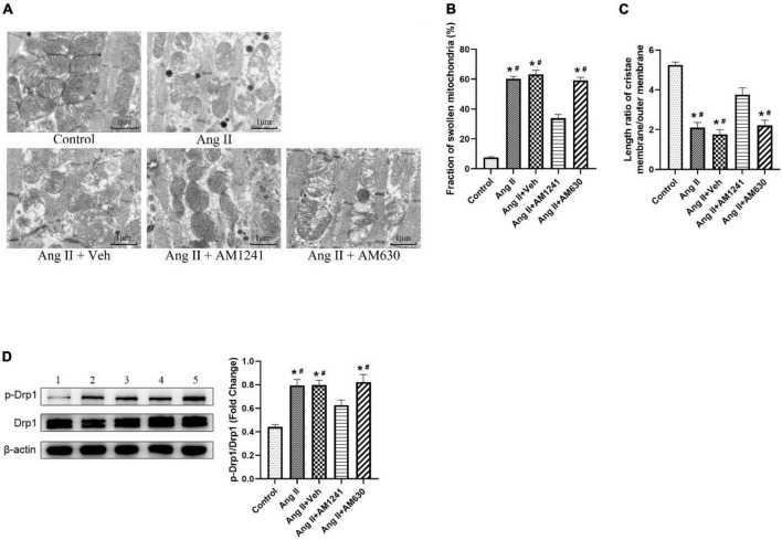 Administration of AM1241 attenuated mitochondrial damage in Angiotensin II-infused mice. (A) Representative transmission electron microscopic images of atrial samples. Bar = 1 μm. (B) Fraction of swollen mitochondria. (C) Length ratio of the mitochondrial cristae membrane and outer membrane, a parameter of mitochondrial cristae density. For each analyzed mitochondrion, the total length of the cristae membrane was obtained by adding the lengths of all the cristae together and multiplying by 2. The ratio was determined by dividing the total length of the cristae membrane by the mitochondrion perimeter. (D) Representative western blot image and relative expression of p-Drp1 and Drp1. Lane 1: control group; Lane 2: Ang II group; Lane 3: Ang II + Veh group; Lane 4: Ang II + AM1241 group; Lane 5: Ang II + AM630 group. The data represent the mean ± SEM. *P < 0.05 vs. control group. #P < 0.05 vs. Ang II + AM1241 group.