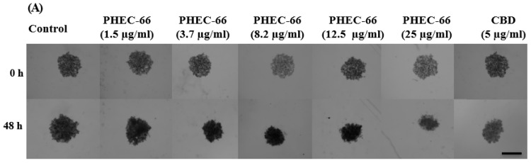 PHEC-66 and CBD treatment reduces the surface area of melanoma cell spheroids. A representative image of the effect of 48 h PHEC-66 and CBD treatment on MM96L spheroids (A). The top panel is of the spheroids at 0 h, and the bottom panel is after 48 h treatment. The spheroids were exposed to PHEC-66 and CBD for 48 h and changes in their surface area can be seen in MM418-C1 (B), MM329 (C), and MM96L cells (D). Asterisks indicate statistically significant differences between untreated spheroids and PHEC-66-treated spheroids (** p = 0.01, *** p = 0.001, **** p < 0.0001 one-way ANOVA with Tukey’s multiple comparisons test). The results expressed are the mean ± SEM (n = 3) (Scale bar = 900 μm).