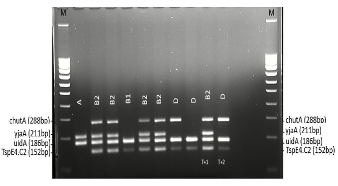 Quadruplex PCR for the detection of ESBL E.coli phylogroups.Legend: M= molecular weight (100 bp DNA ladder); T+I= positive control B2; T+2= positive control D; A-B1-B2-D= Phylogroups detected.