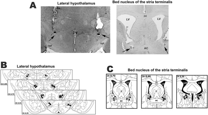 (A) Photomicrographs of coronal brain sections from representative rats showing bilateral sites of microinjection into the lateral hypothalamus (LH) (left) and bed nucleus of the stria terminalis (BNST) (right). (B, C) Diagrammatic representations based on the rat brain atlas of Paxinos and Watson58 indicating the microinjection sites into the lateral hypothalamus (B) and BNST (C) of all animals used for evaluation of the involvement of GABAA receptor within the LH in cardiovascular changes evoked by microinjection of the selective CB1 receptor antagonist AM251 into the BNST. White circles: saline LH + DMSO BNST group; black circles: saline LH + AM251 BNST group; white squares: SR95531 LH + DMSO BNST group; black squares: SR95531 LH + AM251 BNST group. 3V third ventricle, ac anterior commissure, cc corpus callosum, f fornix, IA interaural coordinate, ic internal capsule, LV lateral ventricle, opt optic chiasm, st stria terminalis.