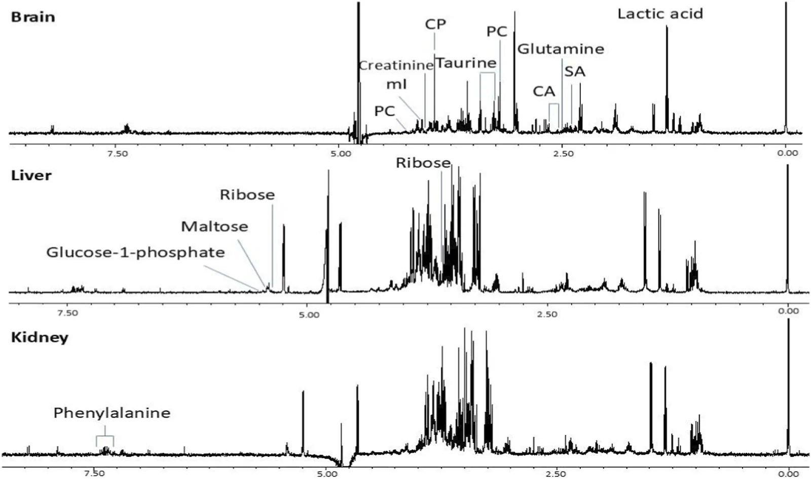 Three aligned one-dimensional nuclear magnetic resonance spectra display metabolite profiles for brain, liver, and kidney tissues, with peaks labeled for specific metabolites such as lactic acid, glutamine, glucose-1-phosphate, ribose, and phenylalanine to indicate tissue-specific differences.
