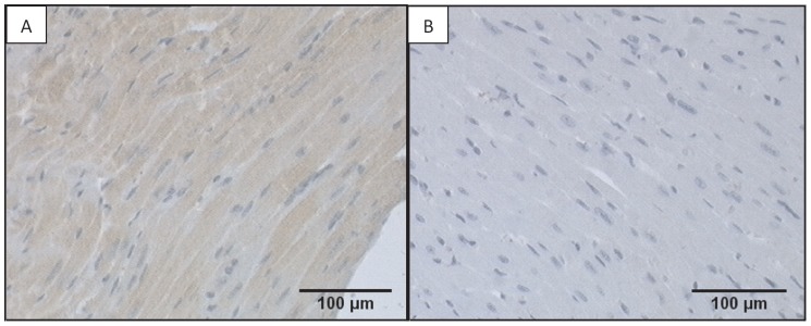 Expression of GPR55 in ventricular tissue from WT and GPR55−/− mice.Photomicrographs taken at ×200 demonstrate positive staining for GPR55 in ventricular tissue (localised to the cardiomyocytes) from WT mice (A), but not GPR55−/− mice (B).