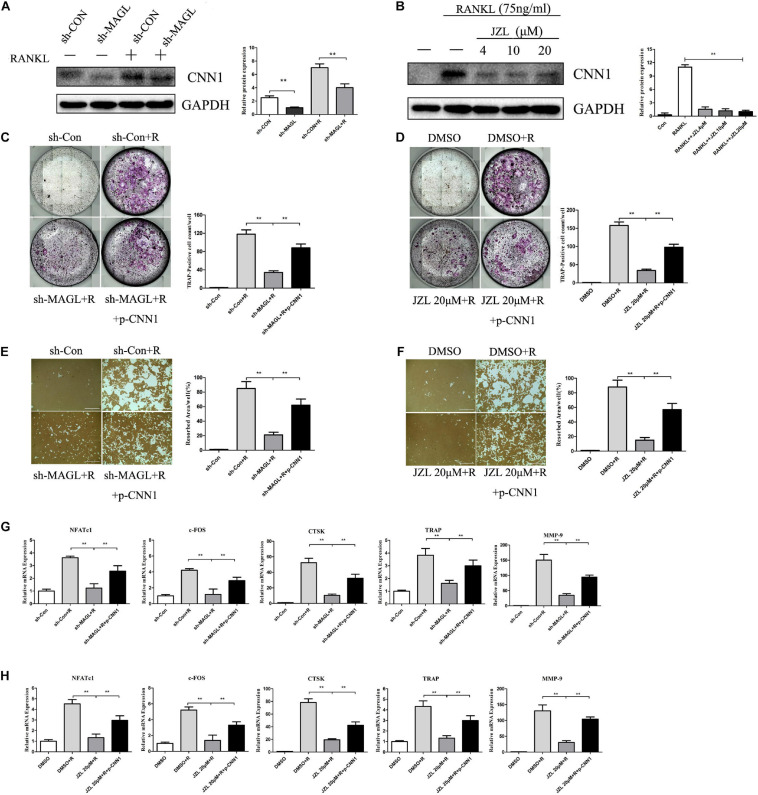 Overexpression of CNN1 alleviates the inhibitory effects of JZL184 or MAGL deletion on osteoclast formation and bone resorption. BMMs were transfected with a CNN1-overexpressing plasmid and then infected with sh-MAGL or pretreated with JZL184. The BMMs were stimulated with or without RANKL (75 ng/mL). (A,B) Total cell lysates were analyzed for CNN1 by Western blot analysis. (C,D) Representative images and TRAP-positive cells (≥3 nuclei) were counted. (E,F) Representative images of resorption pits are shown. (G,H) Total cell lysates were analyzed for the levels of osteoclast-specific genes by qPCR. Data are presented as means ± SD of three independent experiments. **P < 0.01 vs. the vehicle or the control adenovirus or sh-MAGL group.