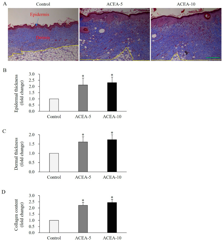 Effects of cannabinoid receptor 1 (CB1) agonist on epithelial and dermal thickness, as well as collagen deposition in wound tissues of a mouse skin full-thickness wound model. (A) Representative histological images by Masson’s trichrome staining on day 15 in wound tissues of mice administered daily with the CB1 agonist arachidonyl-2′-chloroethylamide at doses of 5 mg/kg or 10 mg/kg following injury. Quantitative analysis of epidermal (B), derm thickness (C), and collagen deposition (D). Yellow line is the boundary between dermis and subcutaneous tissues. Scale bar, 50 μm. Data are presented as mean ± SD, with n = 10 mice per group. * p < 0.05 vs. vehicle-treated controls, which were set at 1.0.