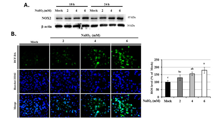 Effects of THC on Src-p47phox-NOX2-mediated ROS in NaIO3-induced ARPE-19 cells. ARPE-19 cells were pretreated without or with various concentrations of (0–50 μM) THC for 1.5 h, followed by incubation without or with different concentrations of NaIO3 (0, 2, 4, and 6 mM) for 18 or 24 h. (A) NOX2 protein expression analyzed by Western blot. (B,C) Intracellular ROS levels and cellular H2O2 production measured using flow cytometry and ELISA, respectively. (D) Western blot and quantitative analysis showing the effects of THC on NOX2 expression, as well as the effects of p47phox and phosphorylation Src-family proteins, in NaIO3-treated ARPE-19 cells. Protein expression was quantified by densitometric analysis and normalized to β-actin or GAPDH as the loading control. Data are presented as mean ± SD, n ≥ 3, p < 0.05. Groups labeled with different letters (a–e) indicate statistically significant differences between them.