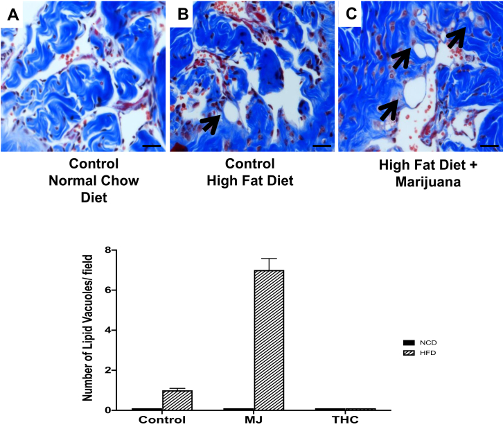 High-fat diet promotes lipid accumulation in the corpora cavernosa. The presence of lipid vacuoles (as indicated by black arrows) are most prominently seen in the corpora cavernosa of mice fed (B) HFD and a combination of (C) HFD + MJ. Fat accumulation was not found in mice administered control NCD or diet with THC combination groups. Magnification: 400×; 1 bar = 50 μm.