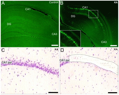 Neuronal CA1 pyramidal cell damage and the region-specific laser microdisecction one week after SE.Fluoro-Jade B staining of a representative control (A) and KA-treated rat (B) one week after SE. Fig.1B shows positively stained CA1 pyramidal neurons (see also the inset in B). Figs.1C and D show hematoxylin-eosin staining of the CA1 pyramidal layer of a KA-treated rat before and after laser microdissection, respectively. Scale bars: A and B: 200 µm; C and D: 75 µm. Abbreviations: CA1 pyr, stratum pyramidale of CA1; DG, dentate gyrus; KA, kainic acid.
