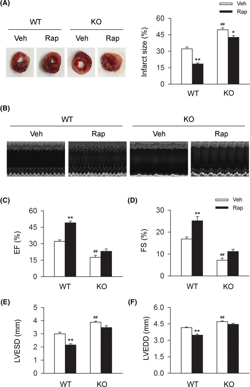 CB2R deficiency largely attenuates the cardiac protective effects of rapamycin in MI miceLeft anterior descending coronary artery was permanently occluded to create MI mice model. In two subgroups of MI mice, rapamycin was given daily (2 mg/kg body weight, i.p.) from 1-week preinfarction to occluding surgery. (A) Representative images of MI heart from WT and CB2R KO mice isolated at 24-h postinfarction. Quantitative analysis of the percentage of infarct size in heart issue (n=nine per group). *P<0.05 versus the corresponding Veh group, **P<0.01 versus the corresponding Veh group; ##P<0.01 versus WT Veh group. (B) Mice continued to be treated with rapamycin daily (2 mg/kg body weight, i.p.) from 24 h after occluding surgery to 24 h before echocardiographic detection. Representative images of 2D guided M-mode echocardiography at 4-week postinfarction. (C–F) Quantitative analysis of 2D guided M-mode echocardiographic detection including EF, FS, LVESD, and LVEDD at 4-week postinfarction (n=seven per group). **P<0.01 versus the corresponding Veh group; ##P<0.01 versus WT Veh group.Rapa, rapamycin; Veh, vehicle;.