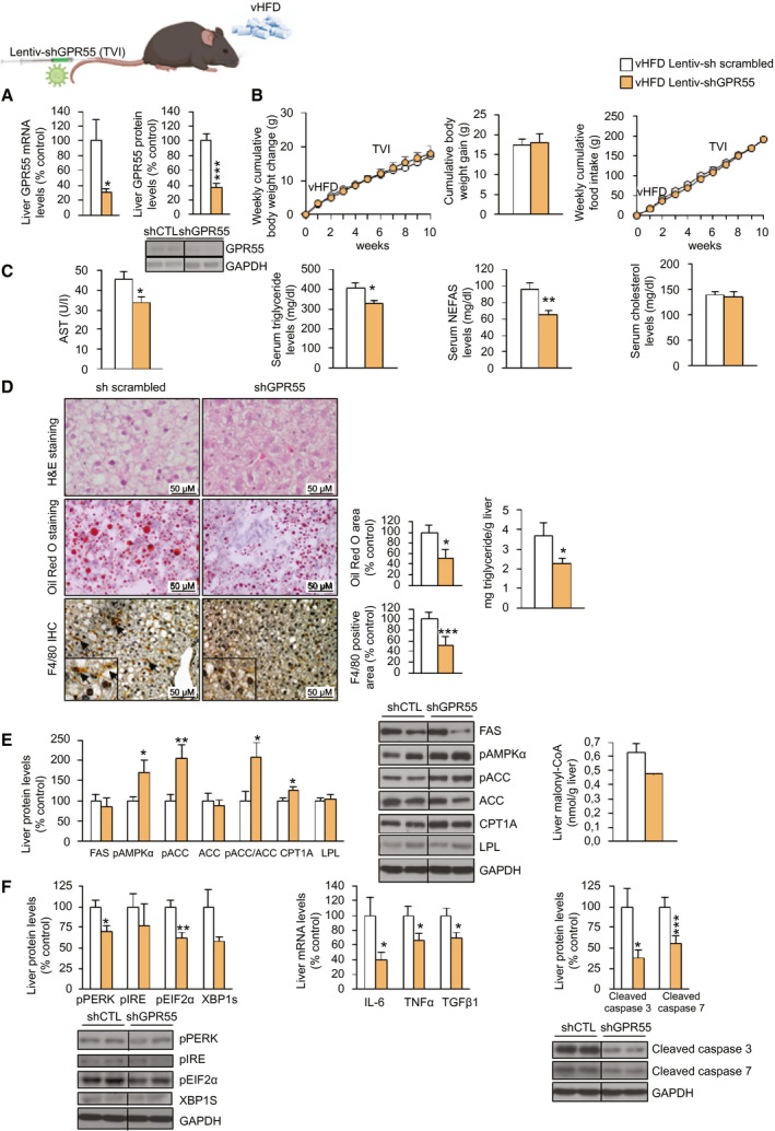 The down‐regulation of hepatic GPR55 ameliorates NAFL induced by a vHFD (60%‐kcal fat content) in mice. C57BL/6J mice fed a vHFD diet for 6 weeks randomly received a TVI with Lentiv‐sh scrambled or Lentiv‐shGPR55, maintaining the vHFD for 4 weeks more. (A) GPR55 mRNA levels in the liver. (B) Body‐weight change and food intake. (C) Serum levels of AST, triglycerides, NEFAs, and cholesterol. (D) H&E staining (upper panel), Oil Red O staining (middle panel), and F4/80‐immunohistochemistry staining (lower panel) of liver sections. Lipids were quantified in the Oil Red O staining sections, and the F4/80‐positive area was quantified in the F4/80‐immunohistochemistry staining sections. Hepatic triglyceride content was also directly measured. (E) Hepatic levels of proteins involved in lipid metabolism and hepatic levels of malonyl‐CoA. (F) Protein levels of ER stress markers, gene expression of inflammatory markers, and cleaved isoforms of apoptotic markers caspase 3 and caspase 7 in the liver. HPRT and GAPDH were used to normalize mRNA and protein levels, respectively. Dividing lines indicate splicing in the same gel. Data are presented as mean ± SEM (n = 7). Statistical differences are denoted by *P < 0.05, **P < 0.01, and ***P < 0.001. Abbreviations: AST, aspartate aminotransferase; CoA, coenzyme A; CPT1a, carnitine palmitoyl transferase 1a; ER, endoplasmic reticulum; FAS, fatty acid synthase; GAPDH, glyceraldehyde 3‐phosphate dehydrogenase; GPR55, G protein–coupled receptor 55; H&E, hematoxylin and eosin; HPRT, hypoxanthine‐guanine phosphoribosyltransferase; i.p., intraperitoneally; Lentiv‐shGPR55, lentiviral vector encoding short hairpin RNA against GPR55; Lentiv‐sh scrambled, lentiviral vector encoding scrambled short hairpin RNA; NAFL, nonalcoholic fatty liver; NEFA, nonesterified fatty acid; pEIF2α, phosphorylated eukaryotic initiation factor 2α; pIRE, phosphorylated iron‐responsive element; pPERK, phosphorylated protein kinase R‐like ER kinase; shCTL, short hairpin RNA control; shGPR55, short hairpin RNA against GPR55; TVI, tail‐vein injection; vHFD, very high‐fat diet; XBP1S, X‐box binding protein 1S.