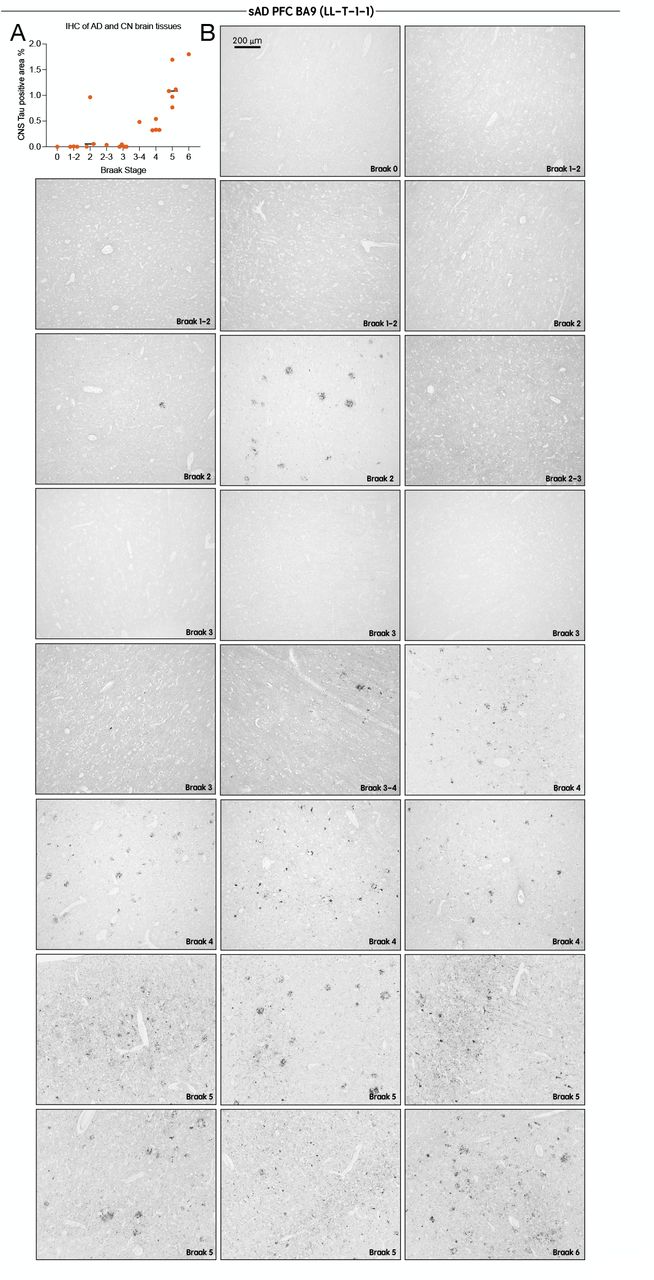 LL-T-1-1 labeling of tau pathology in AD brains reflects Braak stage progression.(A) Quantification of LL-T-1-1 immunohistochemical staining densities in the BA9 region across all Alzheimer’s disease (AD) cases (n = 23). (B) Low-magnification images of LL-T-1-1 immunohistochemistry in the BA9 region of AD brain sections grouped by Braak stages 0–6. LL-T-1-1–positive tau pathology increases with advancing Braak stage, consistent with the characteristic spatial progression of tau pathology in AD.