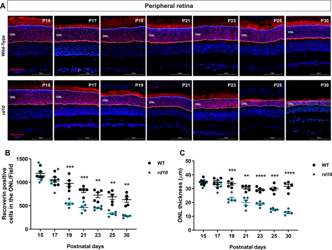 Comparison between strains demonstrated onset of photoreceptor degeneration in retinal periphery at P19 in rd10 mice. Histological sections of the retina’s peripheral area immunostained for recoverin obtained from WT and rd10 animals. A Photomicrographs compare photoreceptor cells (red) at different postnatal ages (15, 17, 19, 21, 23, 25 and 30), and ONL thickness (white dashed lines). Nuclei were counterstained with DAPI (blue). B Analysis of peripheral fields evidenced a cellular reduction from P19 to P30 on rd10 compared to WT. Black circles represent WT animals and blue diamonds rd10. C Quantification of ONL thickness in peripheral fields shows retinal thinning starting at P19 in rd10 animals. ONL—Outer nuclear layer. Calibration bar = 50 μm. Retinal field = 120 μm. Results represent the mean ± SEM of five independent experiments. Each age was analyzed independently using an unpaired Student’s t-test with Welch’s correction. **p < 0.01; ***p < 0.001; ****p < 0.0001
