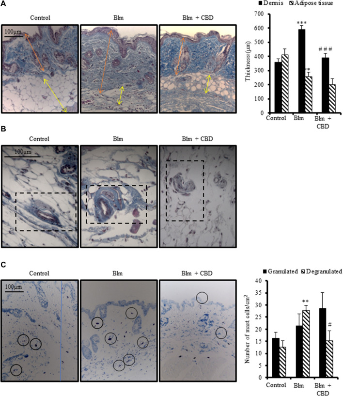 Treatment with CBD reduced skin fibrosis development in a mouse model of systemic sclerosis. Skin fibrosis was induced by daily subcutaneous administration of BLM for 3 weeks and mice were treated in parallel with CBD or vehicle i. p. injections (n = 9 mice per group). (A) Representative images of Masson’s trichrome stained skin sections and quantification of dermal and subcutaneous adipose layers thickness. (B) Masson’s trichrome staining showing collagen around skin blood vessels. (C) Representative images of toluidine blue stained skin sections showing mast cell degranulation and their corresponding quantification. Data represent the mean ± SEM. *p < 0.05; ***p < 0.001 vs control mice. # p < 0.05; # # p < 0.01 vs BLM-treated mice.