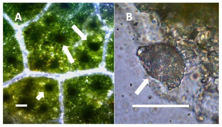 Thespesia populnea leaf nodule bacteria. (A) Leaf stained with acidified diphenylamine to show bacterial masses (leaf nodules; arrows) (Bar = 50 µm). (B) Mass of bacteria (arrow) from leaf nodule stained with acidified diphenylamine to show nitrate (blue color) around bacteria (Bar = 50 µm).