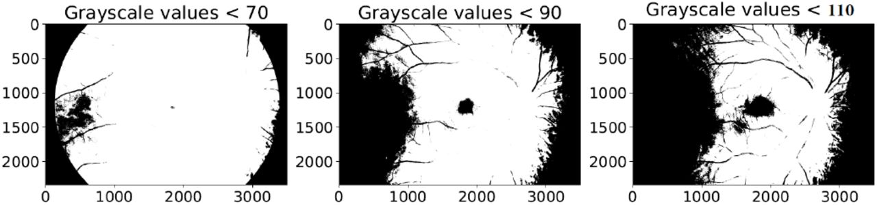 Sublevel filtration.Binary images 𝒳 70, 𝒳 90, 𝒳 110 obtained from a fundus image for threshold values 70, 90, 110.
