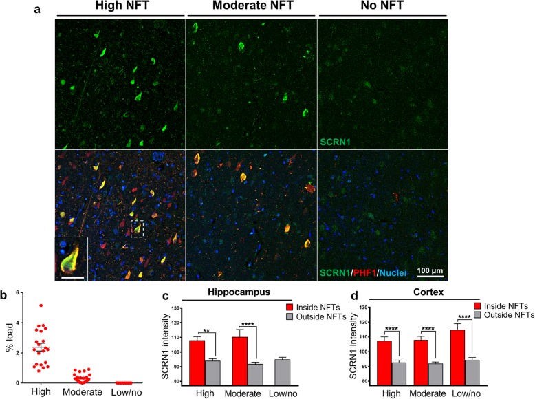 Secernin-1 significantly accumulates in neurofibrillary tangles and dystrophic neurites in AD. a Hippocampus sections were immunostained with α-SCRN1 (green) and PHF1 antibody (red) in all three groups. b PHF1% load in High, Moderate and Low/no NFTs groups. c-d Quantification of staining in the hippocampus and adjacent temporal cortex showed similar basal levels of SCRN1 across the three groups that were not significantly altered by the presence of NFT pathology. In contrast, the amount of SCRN1 in NFTs was significantly higher than that present outside of NFTs in all three groups in hippocampus (c) and temporal cortex (d). **** p-value < 0.0001; ** p-value < 0.01; one-way ANOVA, Tukey’s multiple comparisons test. Scale bar: 25 μm