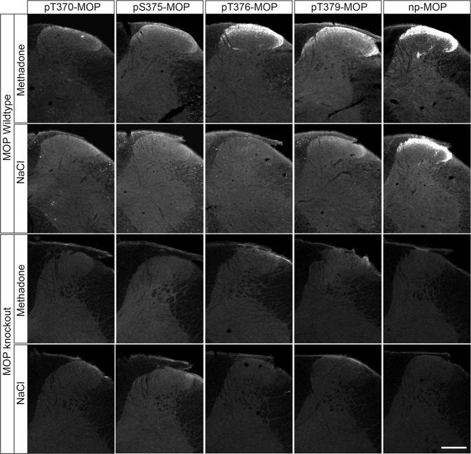 Immunohistochemical staining of agonist-induced MOP phosphorylation in the mouse spinal cord.Animals were treated with methadone or saline for 30 min, transcardially perfused, fixed and stained in the presence of PPIs. Shown are confocal images of coronal sections of the spinal cord stained with phosphosite-specific antibodies pT370-MOP, pS375-MOP, pT376-MOP and pT379-MOP, or phosphorylation independent np-MOP antibody. Note that pS375-MOP, pT376-MOP and pT379-MOP, but not pT370-MOP, revealed an agonist-dependent MOP phosphorylation immunostaining in a pattern closely resembling that of np-MOP immunostaining. Scale bar = 250 µm.