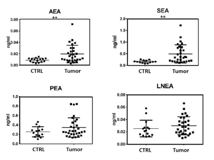 Levels of the ECs and NAEs in urine samples, expressed in ng/mL: arachidonoylethanolamide (AEA), N-palmitoylethanolamide (PEA), N-stearoylethanolamide (SEA), and N-linolenoylethanolamide (LNEA). ECs and NAEs were quantified by HPLC-MS/MS analysis in urine samples of healthy volunteers (CTRL) and patients with bladder cancer (Tumor). The statistical significance of differences was evaluated by the Student’s t-Test, ** p ≤ 0.01.