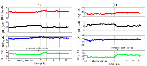 Illustrative thigh muscle oxygenation responses throughout fatiguing exercise in (a) a subject with fibromyalgia (FM) and (b) a healthy control. The oxygenation responses include oxy- and deoxyhemoglobin concentration ([HbO2] and [Hb]), total hemoglobin concentration (THC) and oxygen saturation (StO2), all presented in absolute values. The first two vertical lines indicate the beginning and the end of fatiguing exercise respectively, and the last four vertical lines indicate the time points 3, 6, 9 and 12 minutes after exercise. The arrow indicates the time points immediately post-exercise (over 6 seconds). Note that the muscle motion artifacts during exercise and during maximal voluntary isometric contraction (MVIC) tests at time points 3, 6, 9 and 12 minute post-exercise may contaminate optical measurements, as seen from the peaks in the figure.