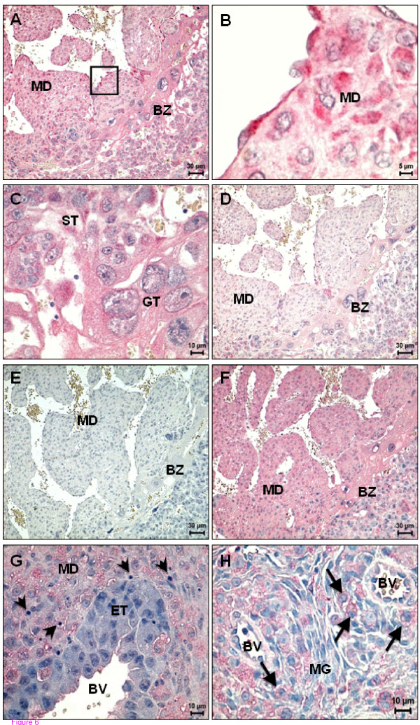 Spatial distribution of cannabinoid and vanilloid receptors on day 14 of pregnancy. (A) CB1 expression, in the mesometrial decidua and basal zone of placenta; (B) High magnification of the square depicted in (A); note the positive decidual and endothelial cells. (C) Higher magnification image of the basal zone. The giant trophoblast and spongiotrophoblast cells are positive for CB1; (D) Expression of CB2 is lower than CB1 in the mesometrial decidua and basal zone; (E) Negative control for TRPV1; (F) TRPV1 expression in the mesometrial decidua and basal zone; (G) High magnification of the mesometrial decidua and endovascular trophoblast cells; note the lack of staining for TRPV1 in these trophoblast cells and the presence of apoptotic bodies in the decidua (arrowheads); (H) Expression of TRPV1 is particularly evident in uNK cells in the metrial gland region (arrows). BV - Blood vessel; BZ - Basal zone; ET - Endovascular trophoblast cells; GT - Giant trophoblast cells; MD - Mesometrial decidua; MG - Metrial gland; ST - Spongiotrophoblast cells.
