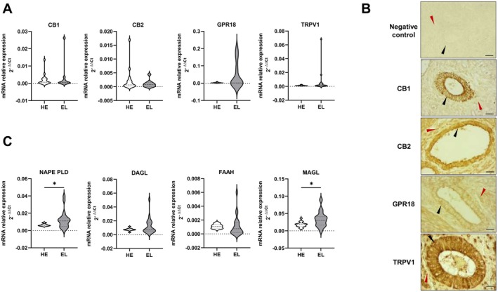 Cannabinoid receptors and enzymes are expressed in human endometriotic lesions. (A) qPCR analysis was performed using TaqMan Gene Expression Assay probes specific for cannabinoid receptors CB1, CB2, GPR18, and TRPV1 in the endometrium of healthy women (HE) (n = 15) or endometriotic lesions (EL) of different localization (n = 20: 7 ovarian endometriosis and 13 deep infiltrating endometriosis). Results were analyzed employing the 2−ΔCt method. (B) Representative immunohistochemical images of CB1, CB2, GPR18 and TRPV1 expression in endometriotic lesions (n = 15: 11 ovarian endometriosis and 4 deep infiltrating endometriosis). The staining with DAB produced a brown precipitate at the site of antibody binding, localized both in epithelial (black arrows) and stromal (red arrows) cells of the endometriotic lesions. The negative control was obtained by processing tissue sections in parallel with the same IHC protocol, omitting the primary antibody. Magnification: ×40, scale bar: 30 μm. (C) qPCR analysis was performed using TaqMan Gene Expression Assay probes specific for cannabinoid enzymes NAPE‐PLD, DAGL, FAAH, and MAGL in the endometrium of healthy women (HE) (n = 15) or endometriotic lesions (EL) of different localization (n = 20: 7 ovarian endometriosis and 13 deep infiltrating endometriosis). Results were analyzed employing the 2−ΔCt method. NAPE‐PLD and MAGL mRNA levels are significantly increased in EL compared to HE (Student's t‐test *p < 0.05).